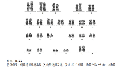 细胞核型分析助力某生物科技企业解决细胞遗传稳定性验证难题