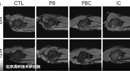 兔后肢冈下肌腱骨止点 Micro CT 成像